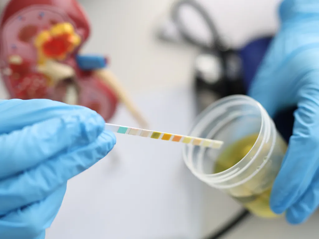 Campo Laboral Especialización Urología UDLA